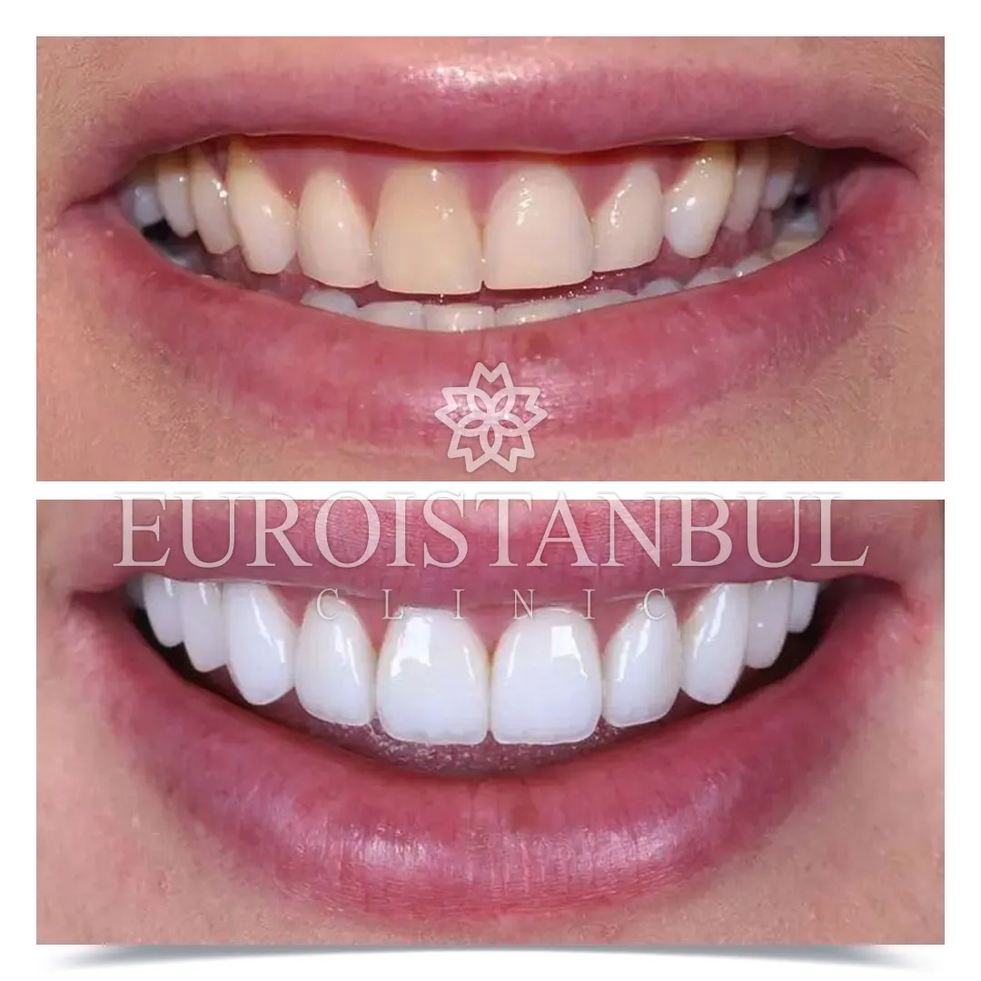 Dental Treatment Before & After Photos