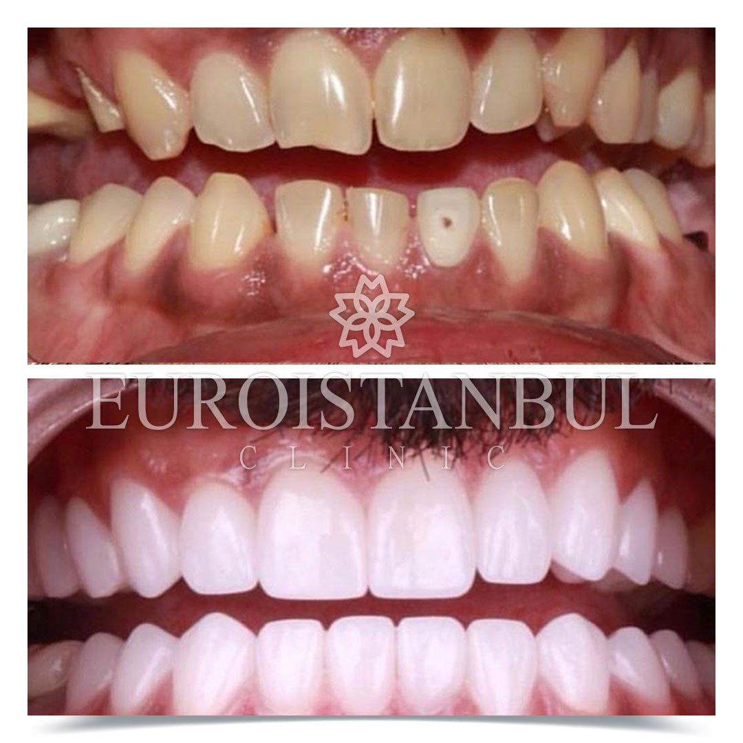 Dental Treatment Before & After Photos