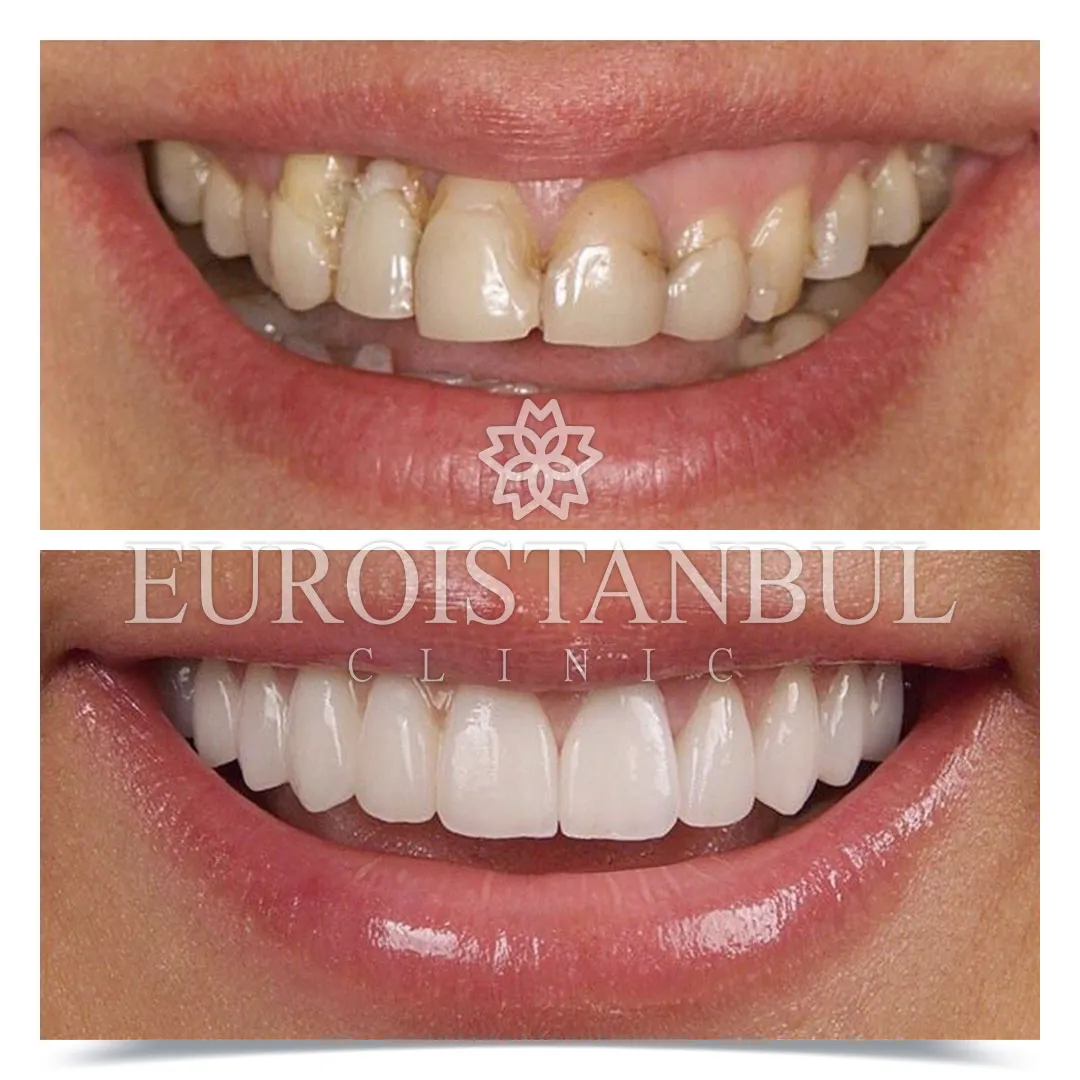 Dental Treatment Before & After Photos