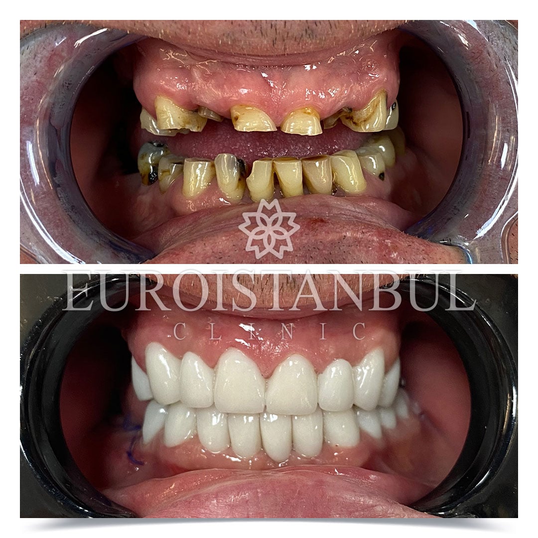 Dental Treatment Before & After Photos